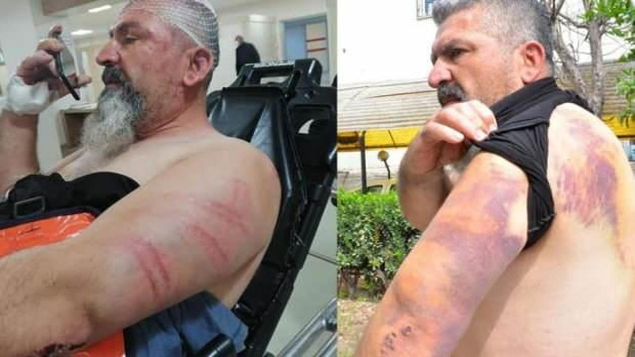 Trafik kazası yaptı, anlattıkları şoke etti!