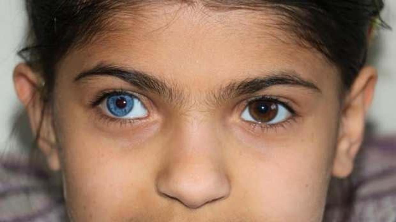 Yasin ve Elif kardeşler hayata &ccedil;ift renk bakıyor