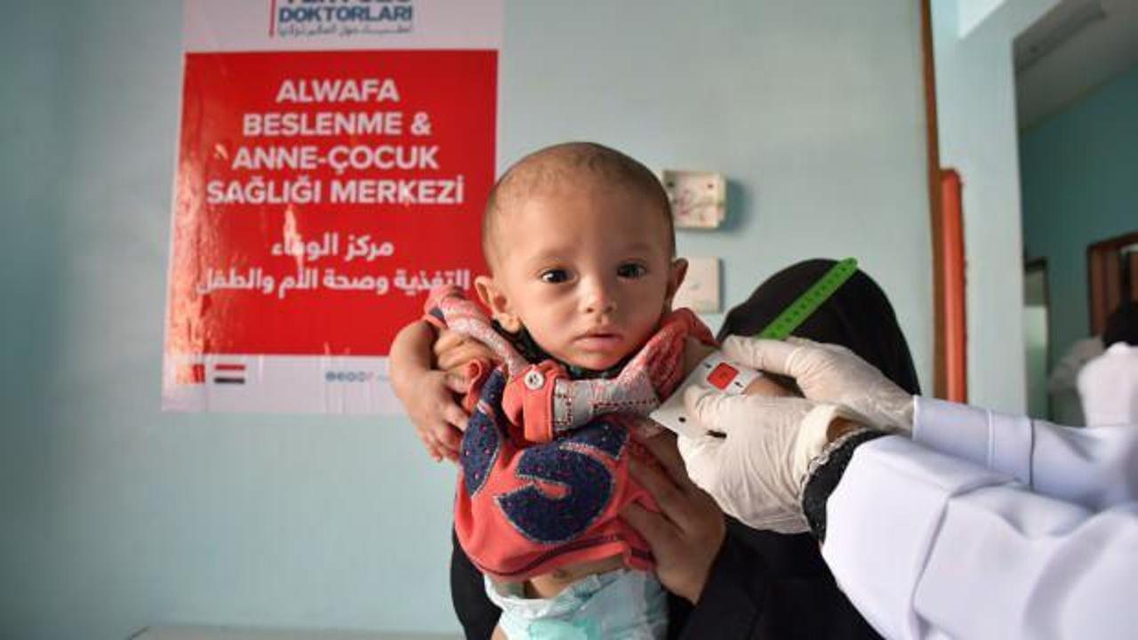 Yeryüzü Doktorları ve Nef Vakfı Yemen’de açlık ile mücadele ediyor