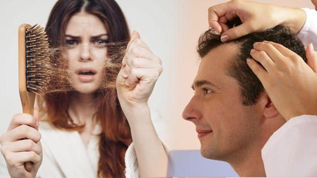Koronavirüs geçirenlerde 6 aya kadar saç dökülmesi görülüyor!