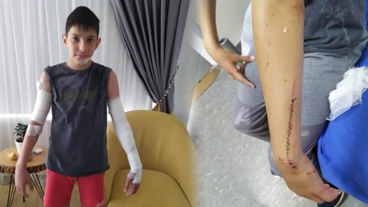 Sakarya'da yüzü ve kollarında kesikler oluşan çocuğa 70 dikiş atıldı!
