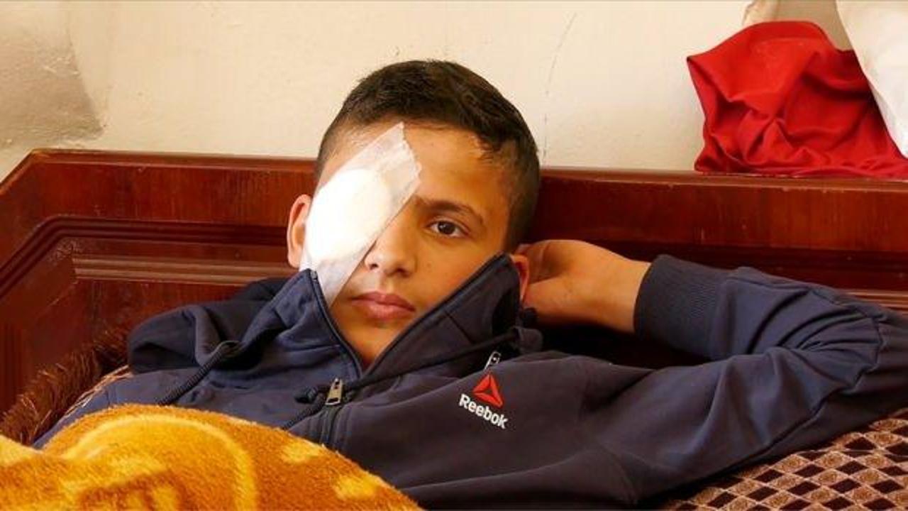 Filistinli çocuk hem gözünü hem de hayallerini kaybetti