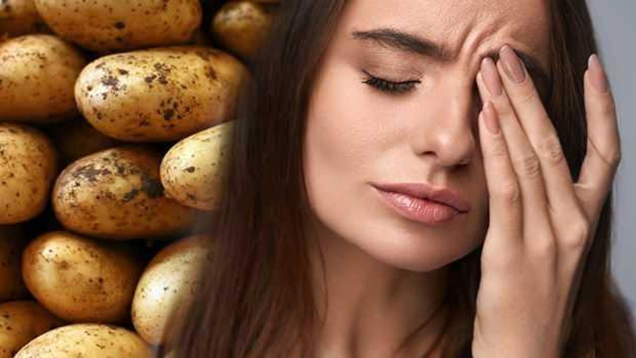Patates göz ağrısına iyi gelir mi? Göz ağrısı anında nasıl geçer?
