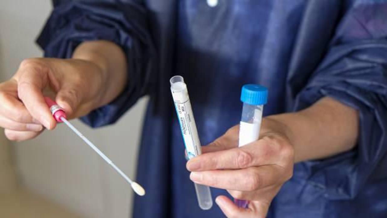 PCR testi nerelerde zorunlu? Aşı olmayanlar işten çıkarılır mı? PCR testi ücretli mi? 