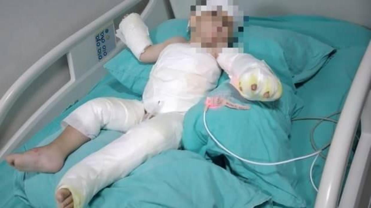İzmir'de koca dehşeti: Eşi ve bebeğini yaktı 