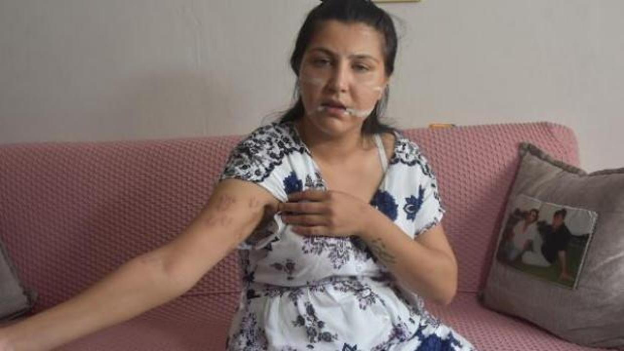 104 yerinden bıçakladığı çocuğunun annesi can çekişirken başında sigara içmiş