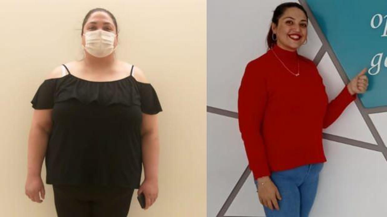 Eskişehir'de 24 yaşındaki genç kız 1 yılda 80 kilo verdi
