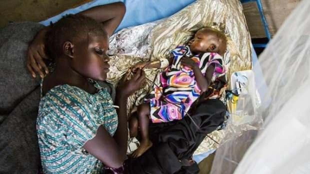 Hastalığın henüz adı yok ancak şimdiden 165 çocuk hayatını kaybetti