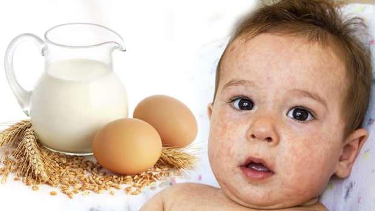 Çocuklarda en çok süt, yumurta ve susam alerjisi görülüyor