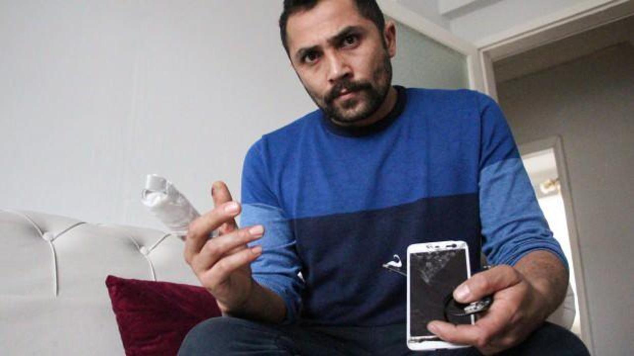 Erzurum&rsquo;da korkun&ccedil; olay! Bir anda patladı parmağını kopardı