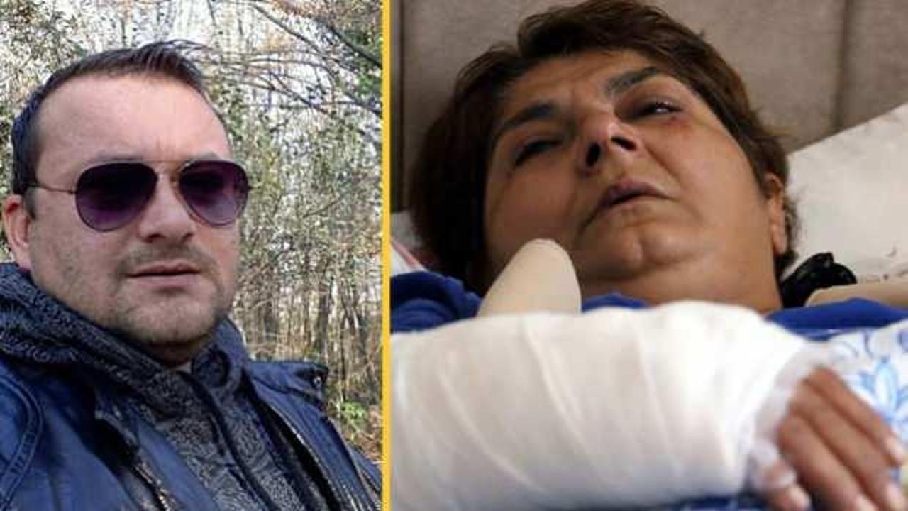 Yengesini baltayla yaralayan caninin cezası belli oldu!