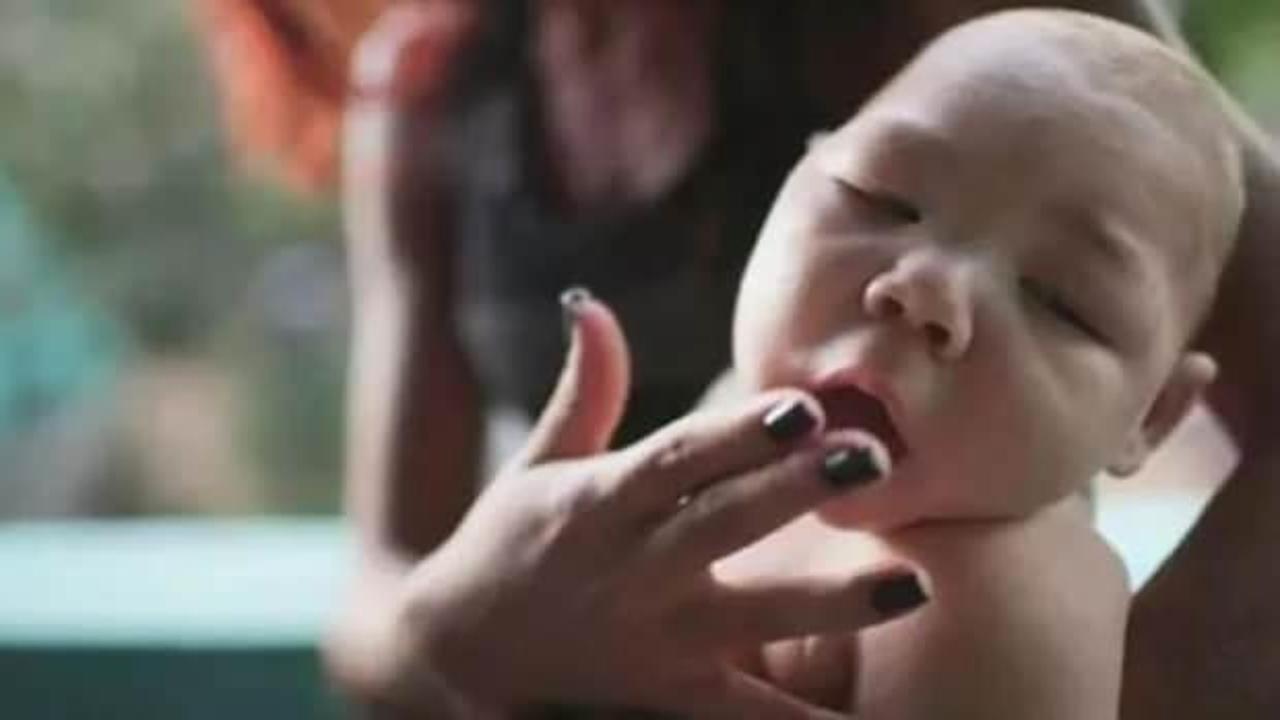 Hindistan'da korkutan virüs paniği: 89 kişide görüldü