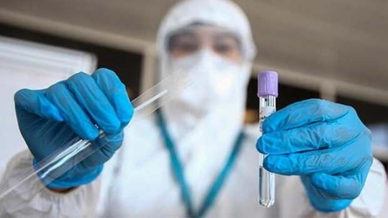 Türk bilim insanları üretti: Koronavirüsü 15 saniyede teşhis ediyor