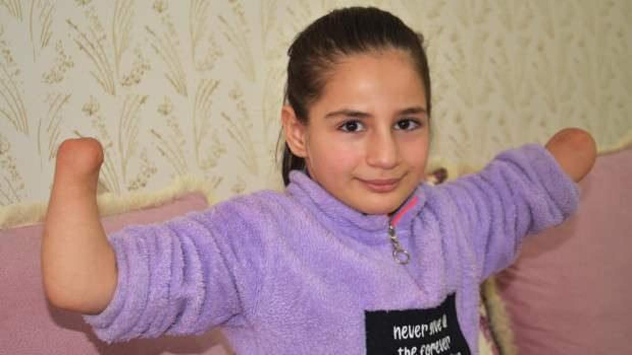 Doğuştan el ve ayak parmakları olmayan 11 yaşındaki Rabia protez el istiyor