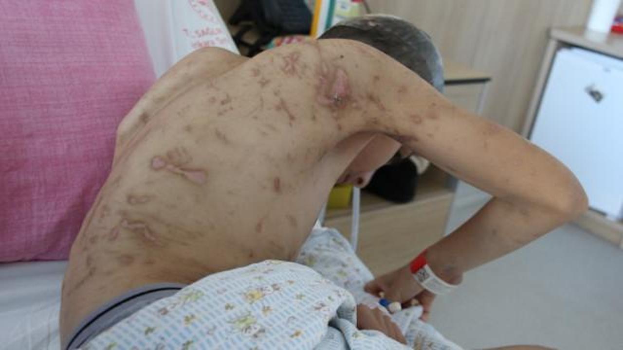 K&ouml;pek saldırısına uğramıştı! 9 operasyon ge&ccedil;irdi ama yetmedi