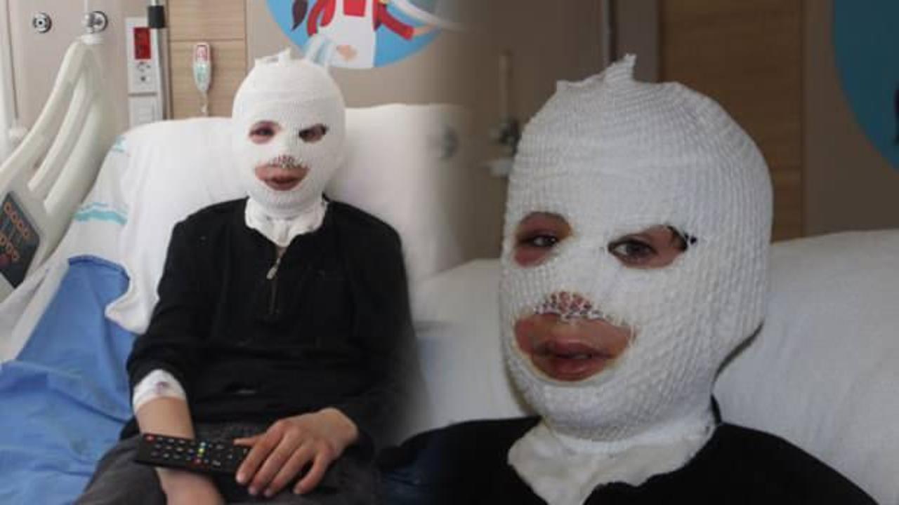 Erzurum&rsquo;da feci olay! Isınmak isterken &ccedil;aydanlık &uuml;zerine devrildi   