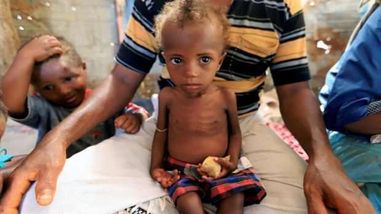ABD'den Yemen'e 585 milyon dolar insani yardım