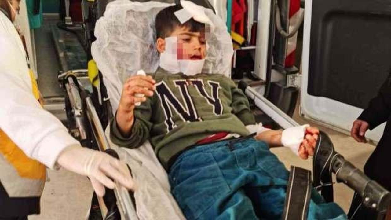 7 yaşındaki Ahmet'e köpekler saldırdı! Hayati tehlikesi var