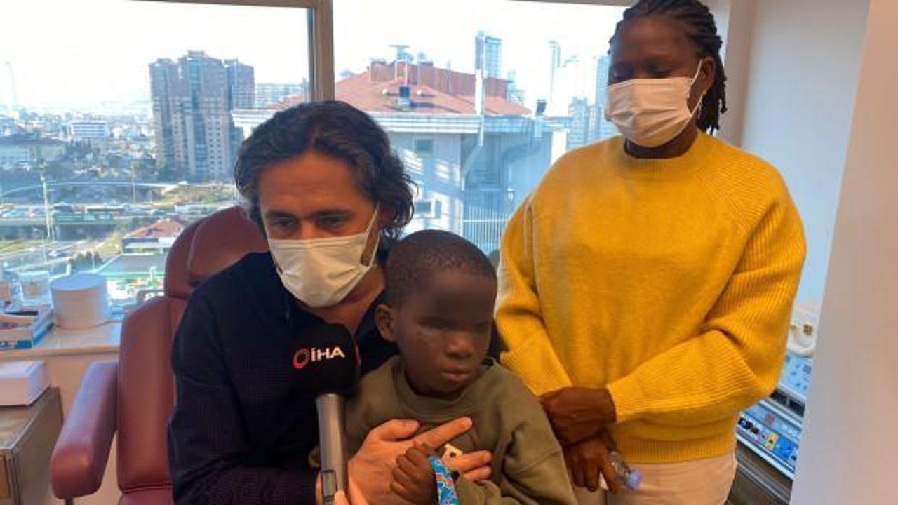 2 aylıkken üvey annesi asitle yüzünü yaktı! Afrikalı çocuk Türkiye'de tedavi olacak