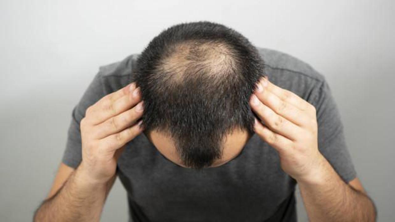 Duygusal travmalar ani saç kayıplarına neden olabiliyor