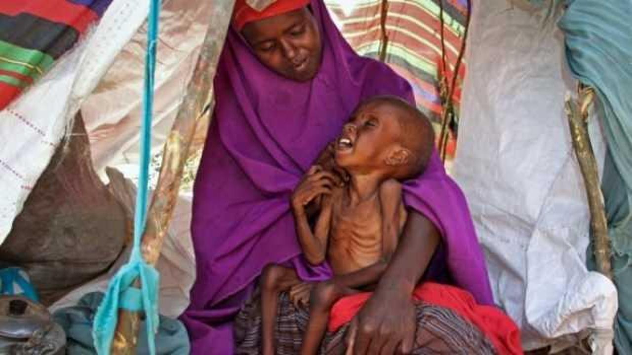 Kuraklık Somali'de 3 can aldı: 2'si çocuk