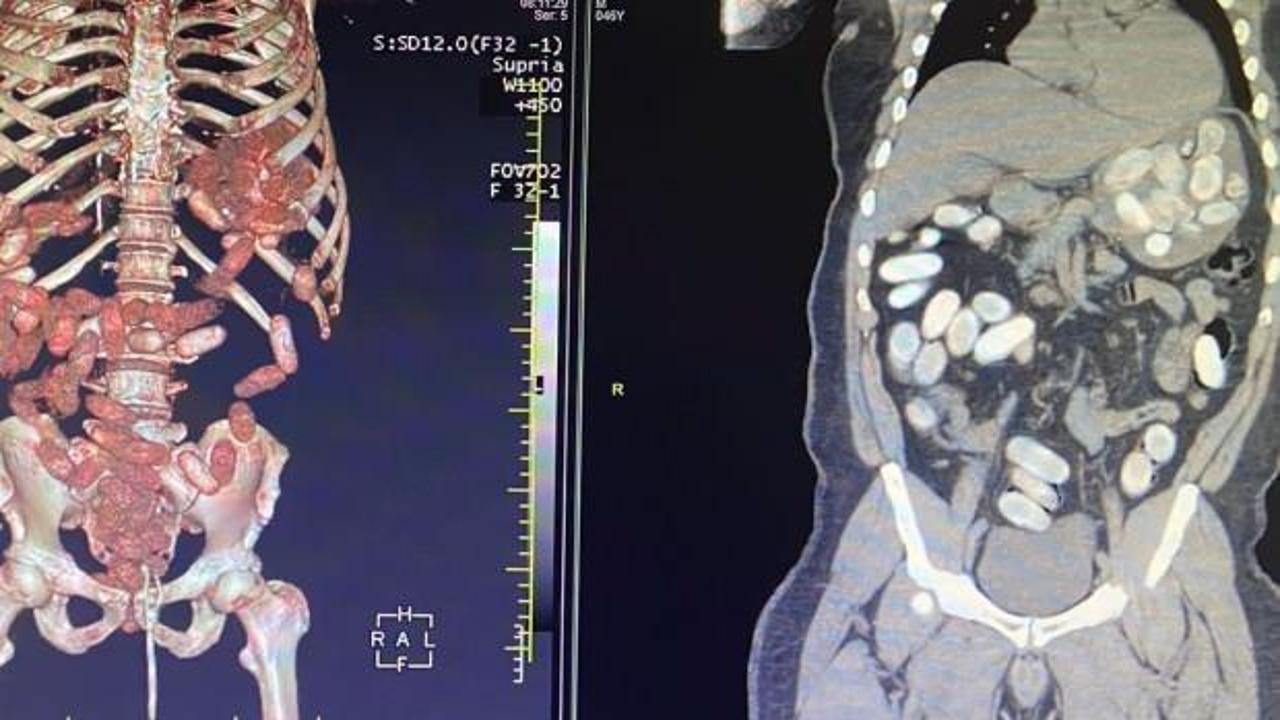İstanbul Havalimanı&rsquo;nda uyuşturucu operasyonu:  11 kilo kokain ele ge&ccedil;irildi!
