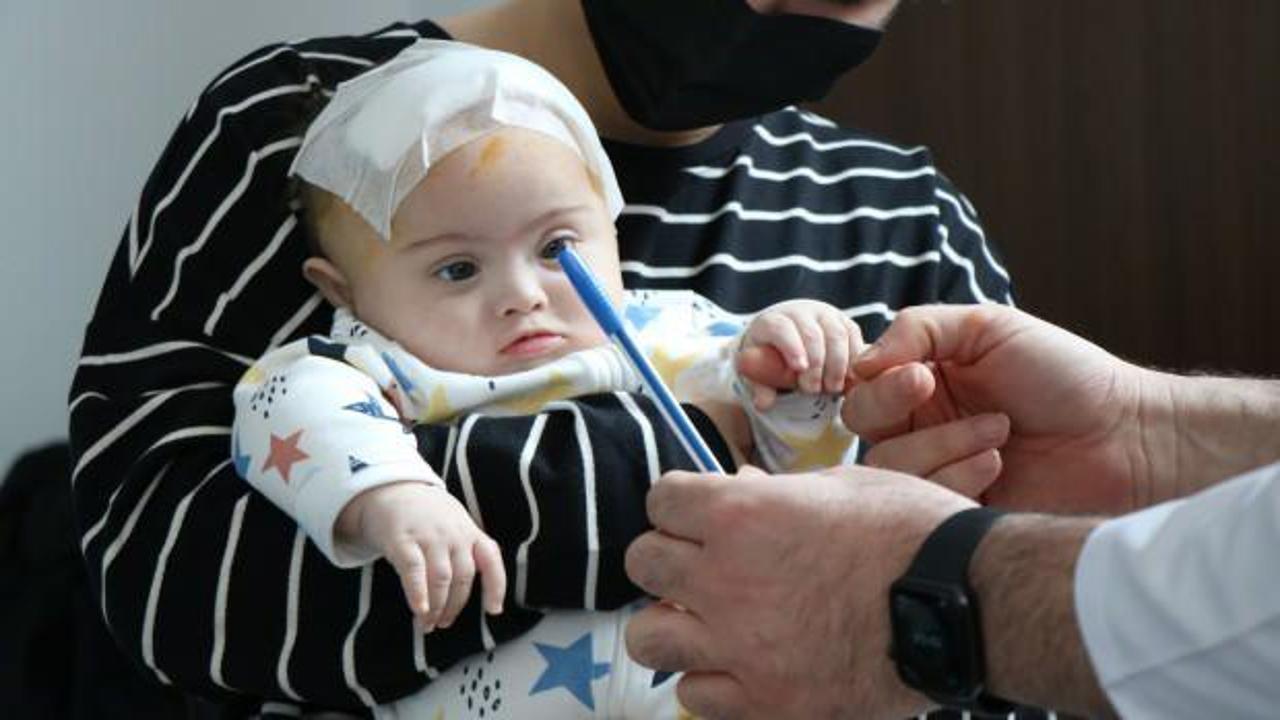 4,5 aylık Gürcistanlı Niko bebek ölümcül tümörden Samsun'da kurtuldu