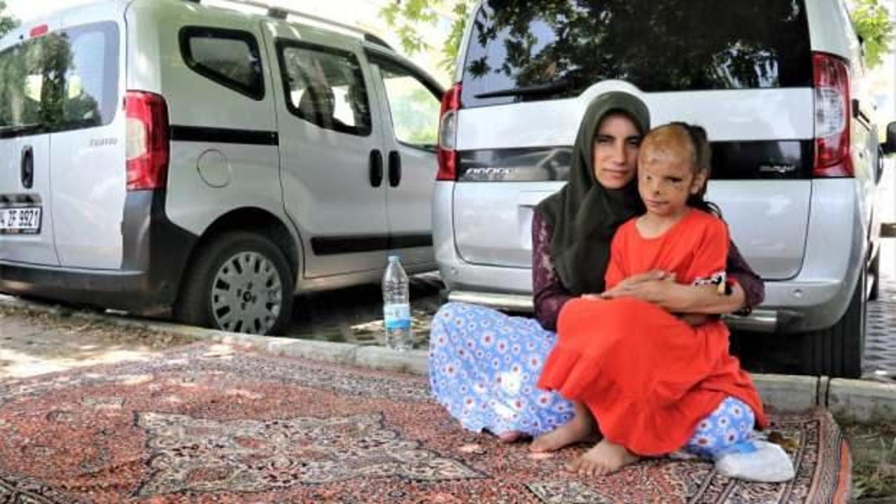 İzmir'de y&uuml;z&uuml; yanan 6 yaşındaki Dilara'ya, Sağlık Bakanlığı el uzattı