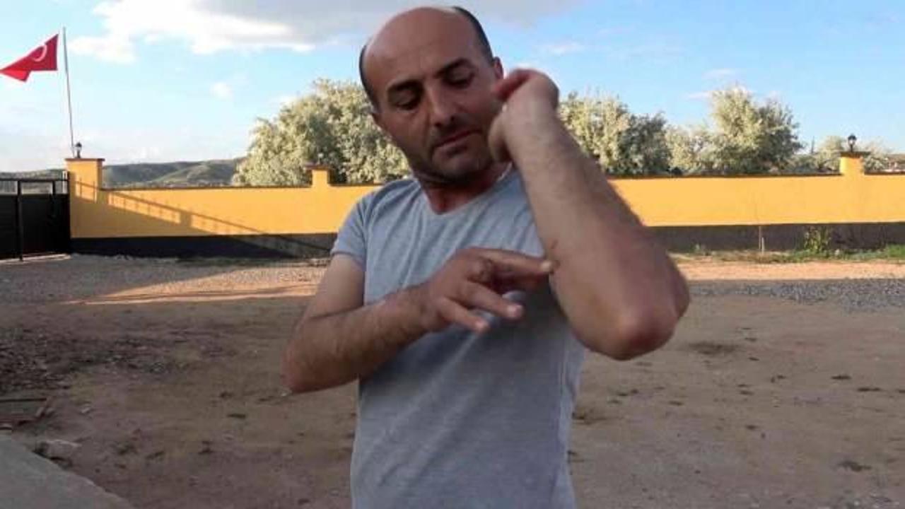 Yıllardır baktığı 'Belçika Malinois' cinsi kurt köpeğin saldırısına uğradı
