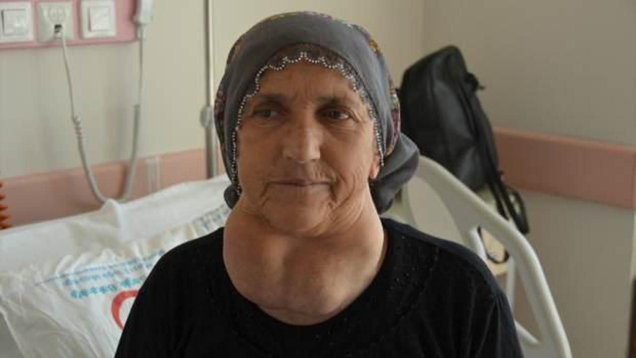 Ameliyat korkusu yüzünden 30 yıl bekledi: Boynundan 1 kilogramlık guatr kitlesi çıkarıldı!