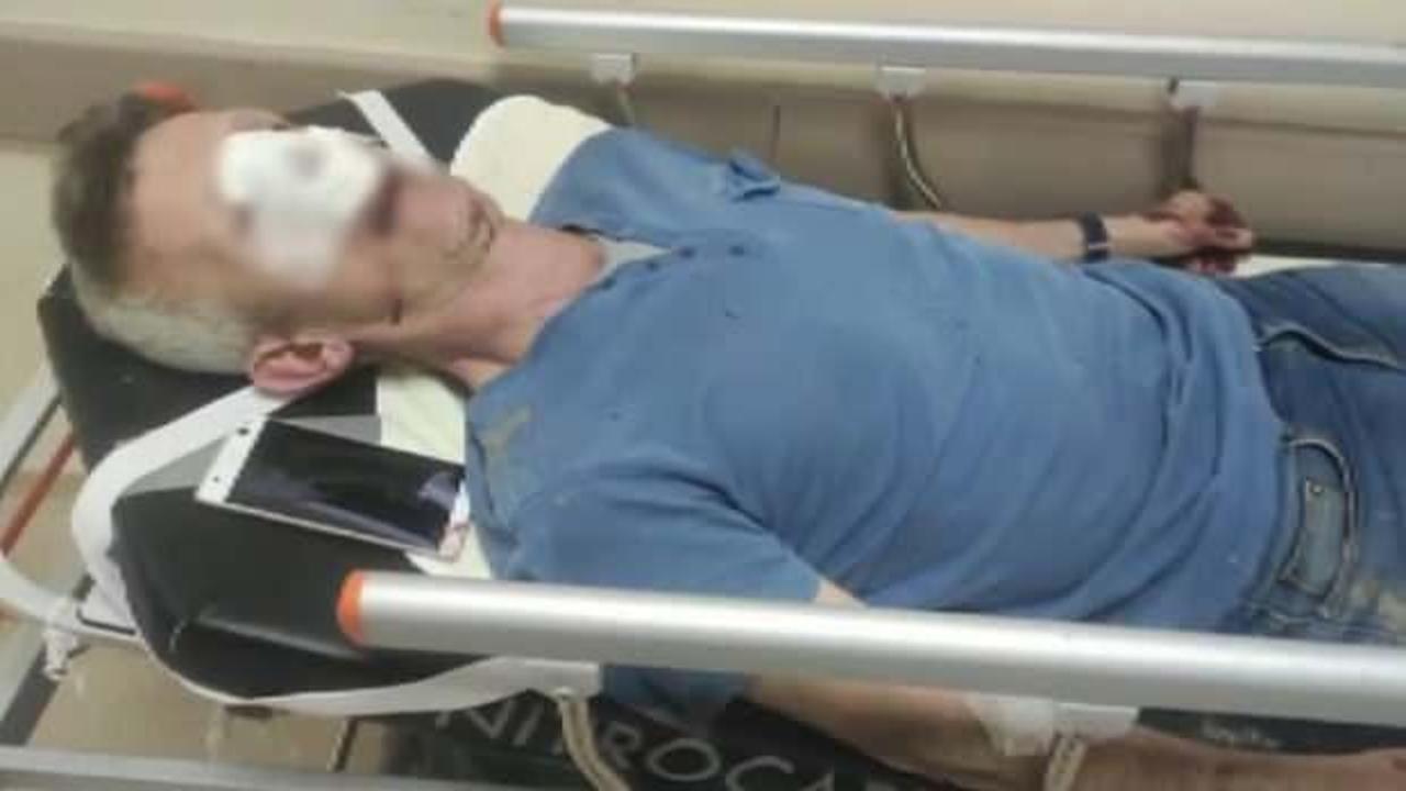 Sitedeki y&uuml;zde 140'lık zamma karşı eylem yaptı, y&ouml;neticiden dayak yedi