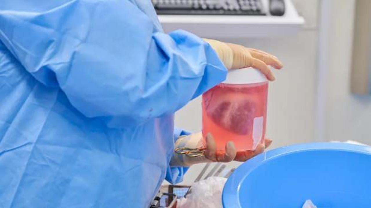 Şok eden insan-domuz deneyi! Genetiği değiştirilmiş domuz kalbi iki ölü insana nakledildi