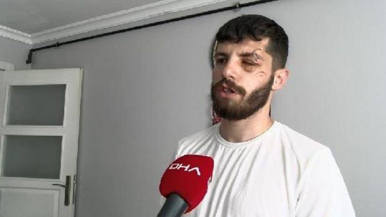 Bağcılar'da maaşını istediği muhasebeci bardak fırlattı iddiası, g&ouml;z&uuml;ne 32 dikiş atıldı