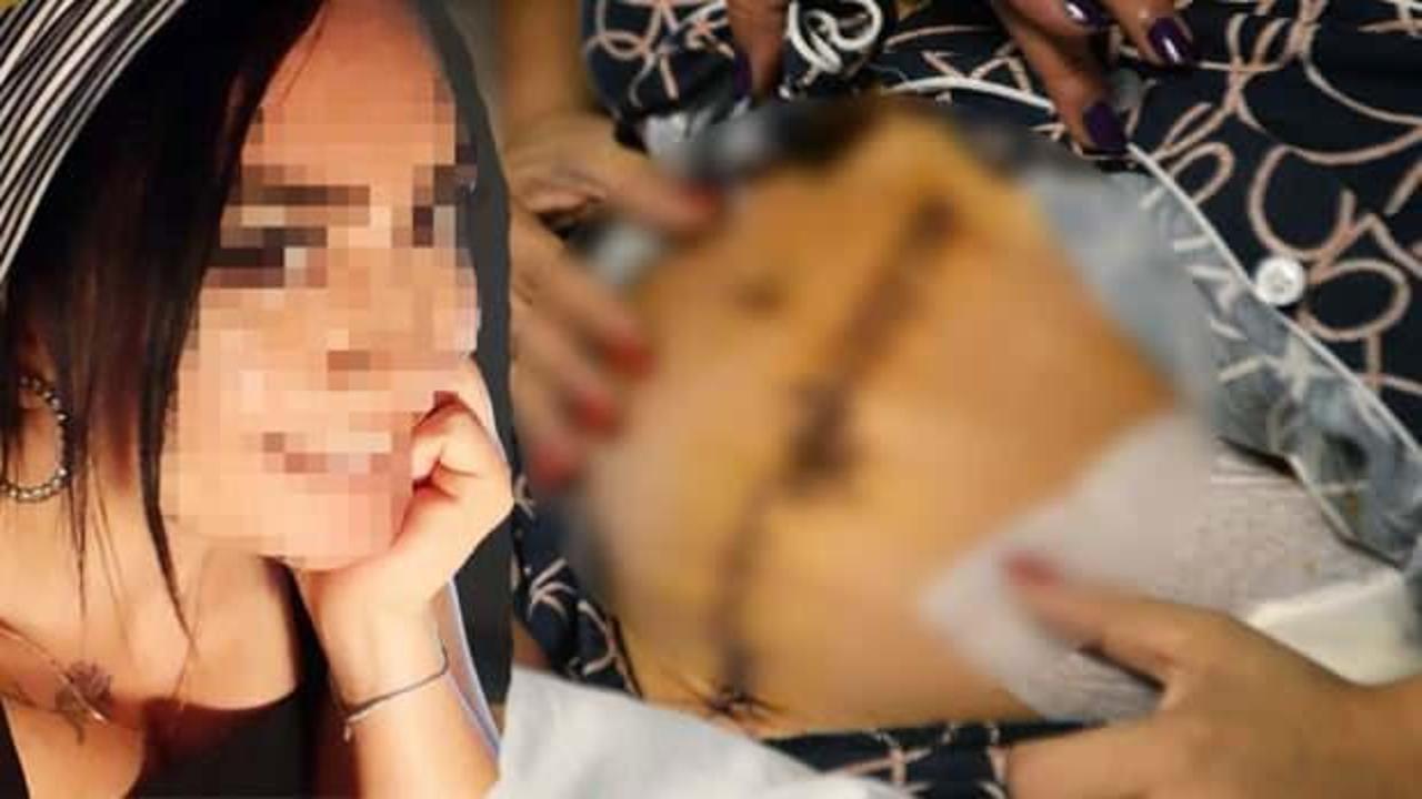 Eski sevgilisi dehşeti yaşatmıştı! Midesinin yüzde 30'u alınıp, vücuduna 135 dikiş atıldı