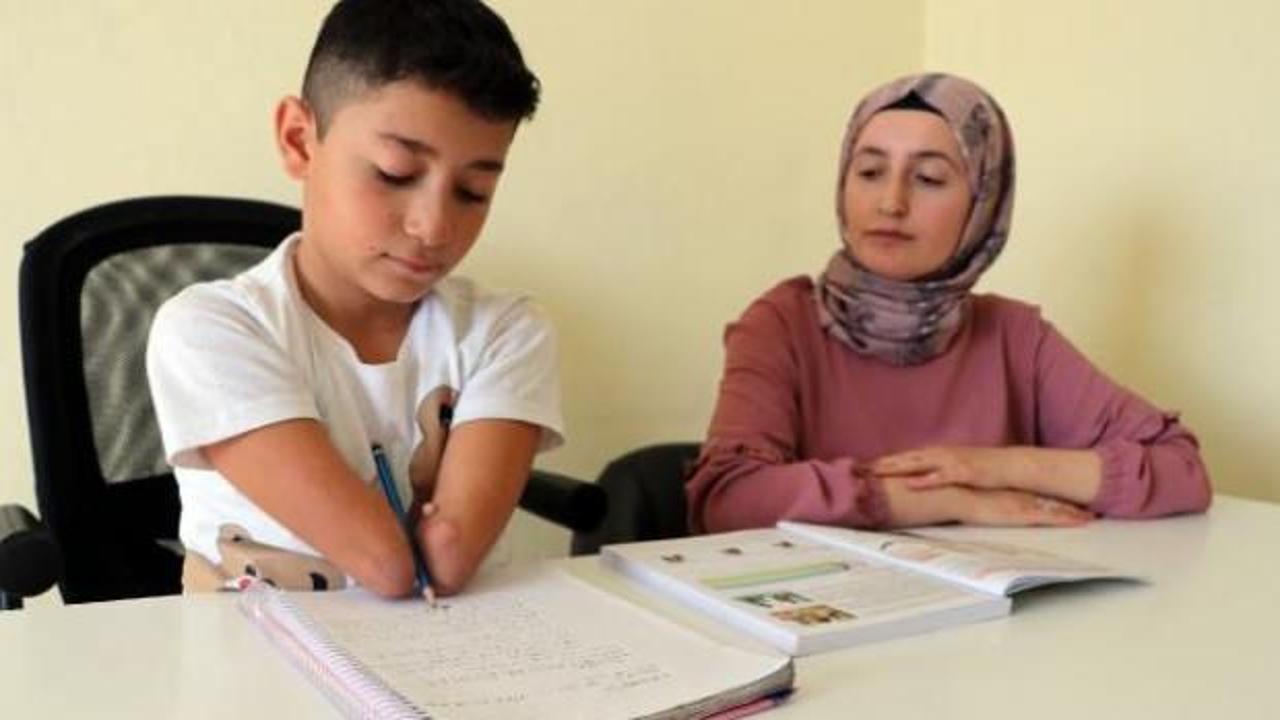 Kolları ve bacakları olmayan Nakşi'nin en b&uuml;y&uuml;k isteği protez