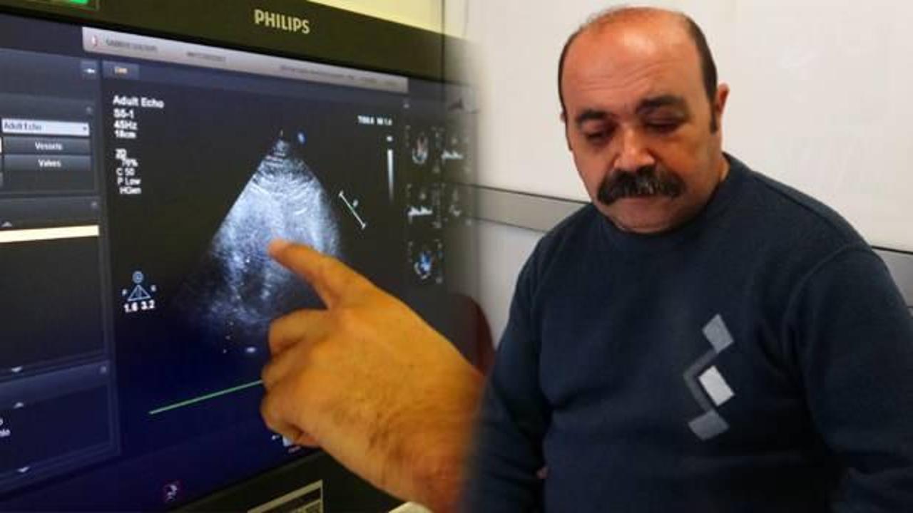 Doktorun &ouml;nerisini reddetti, hastaneden &ccedil;ıkar &ccedil;ıkmaz &ouml;l&uuml;mden d&ouml;nd&uuml; 