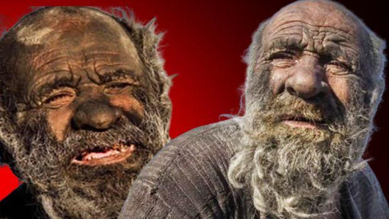 70 yıldır yıkanmayan "Hacı Amca", duş alınca hayatını kaybetti