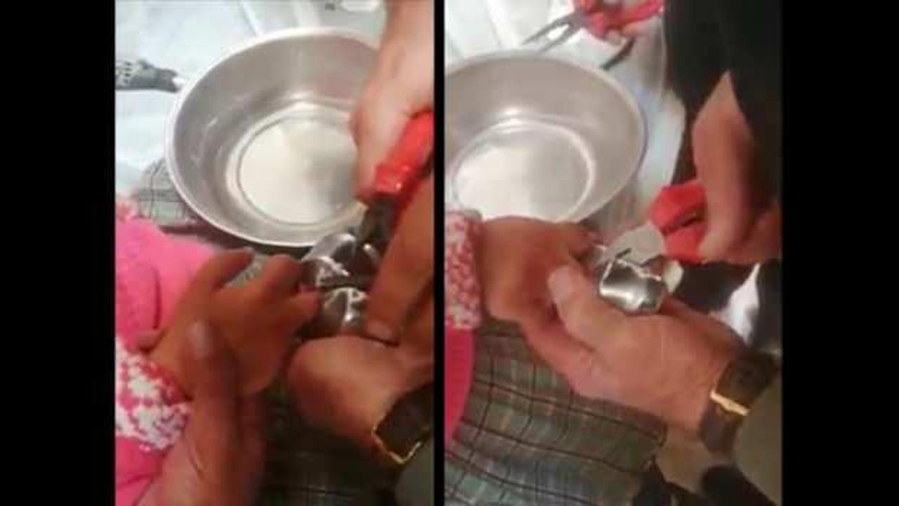 Parmağı kapı kolunun par&ccedil;asına sıkışan minik kızın imdadına itfaiye yetişti