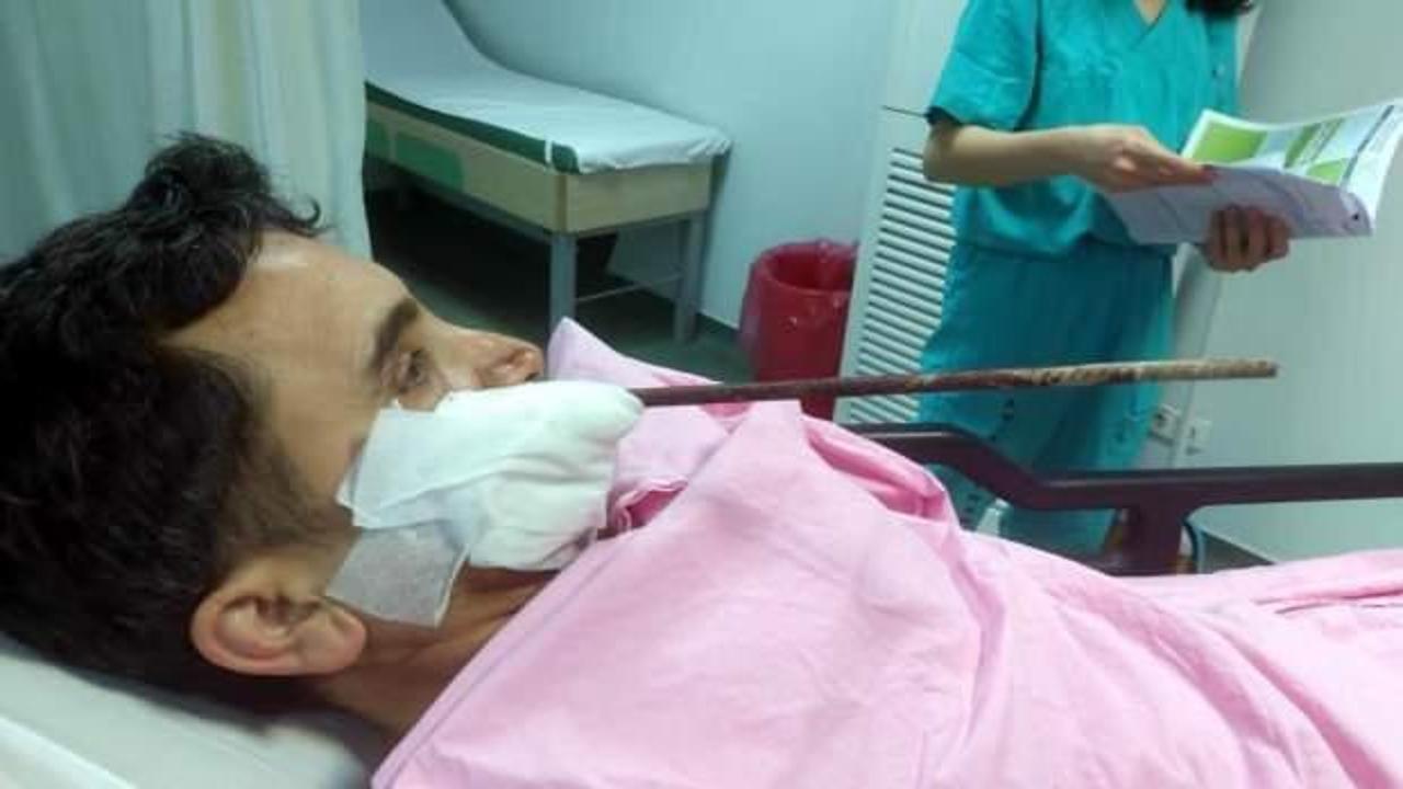 Giresun'da korkun&ccedil; olay! İnşaat demiri y&uuml;z&uuml;ne saplandı