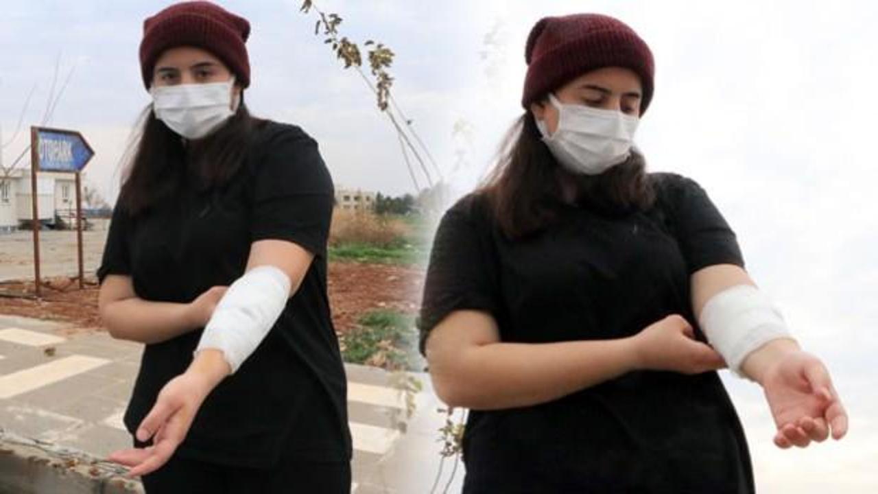 Şanlıurfa’da üniversite kampüsünde köpek saldırısı: Canımı zor kurtardım