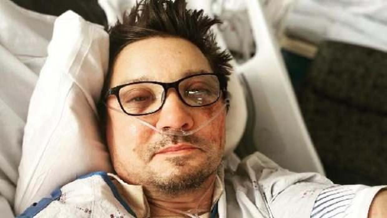 Ünlü aktörden kaza sonrası selfie: Dağıldım