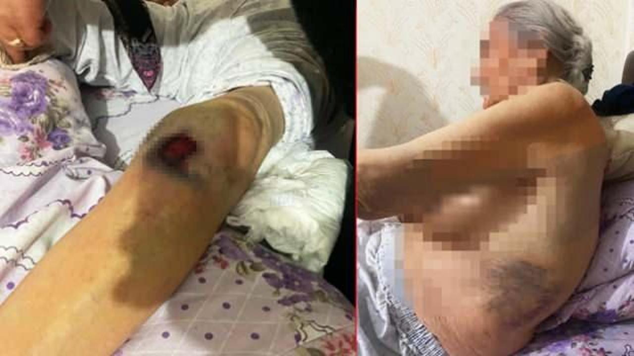 Ankara&rsquo;da işkence: 91 yaşındaki kadını hastanelik ettiler!