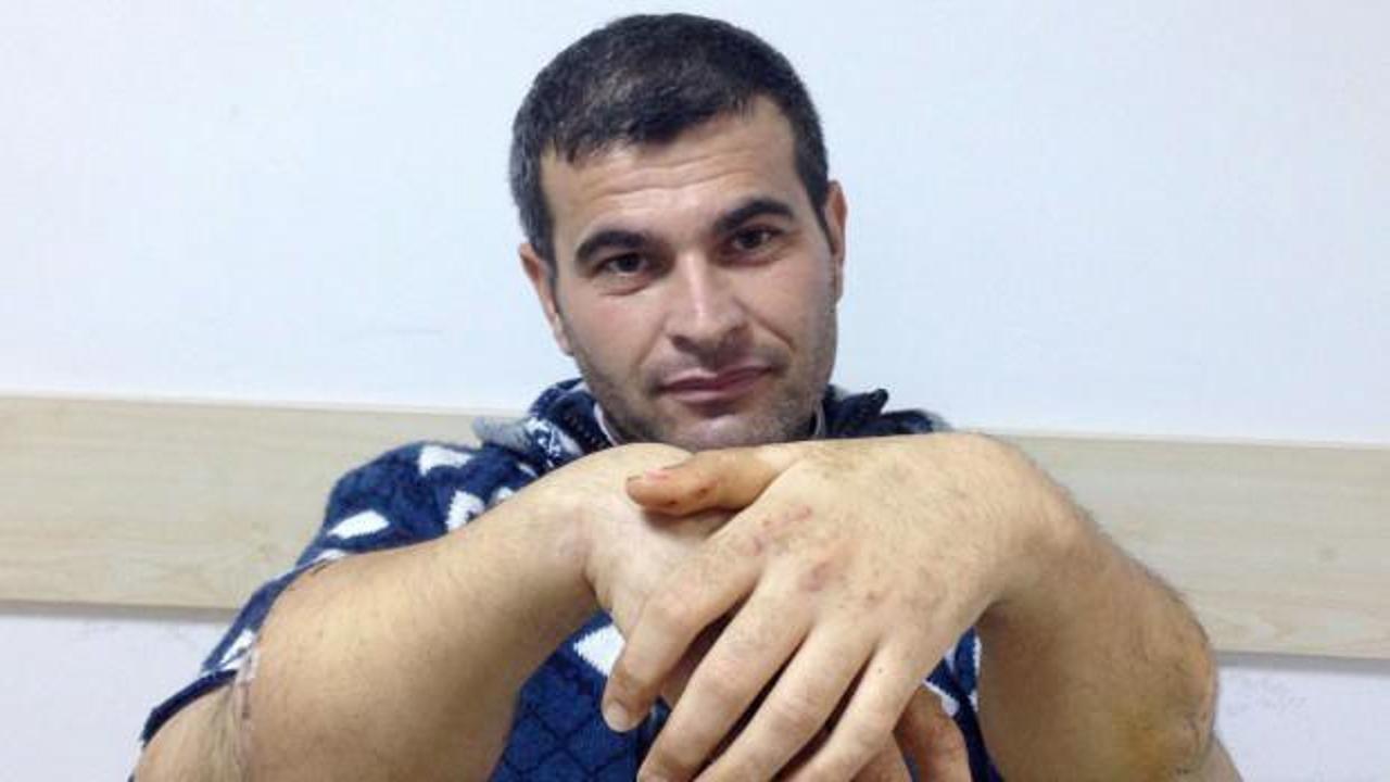 Türkiye’de çift kol nakli yapılan 4'üncü kişiydi: Depremde hayatını kaybetti