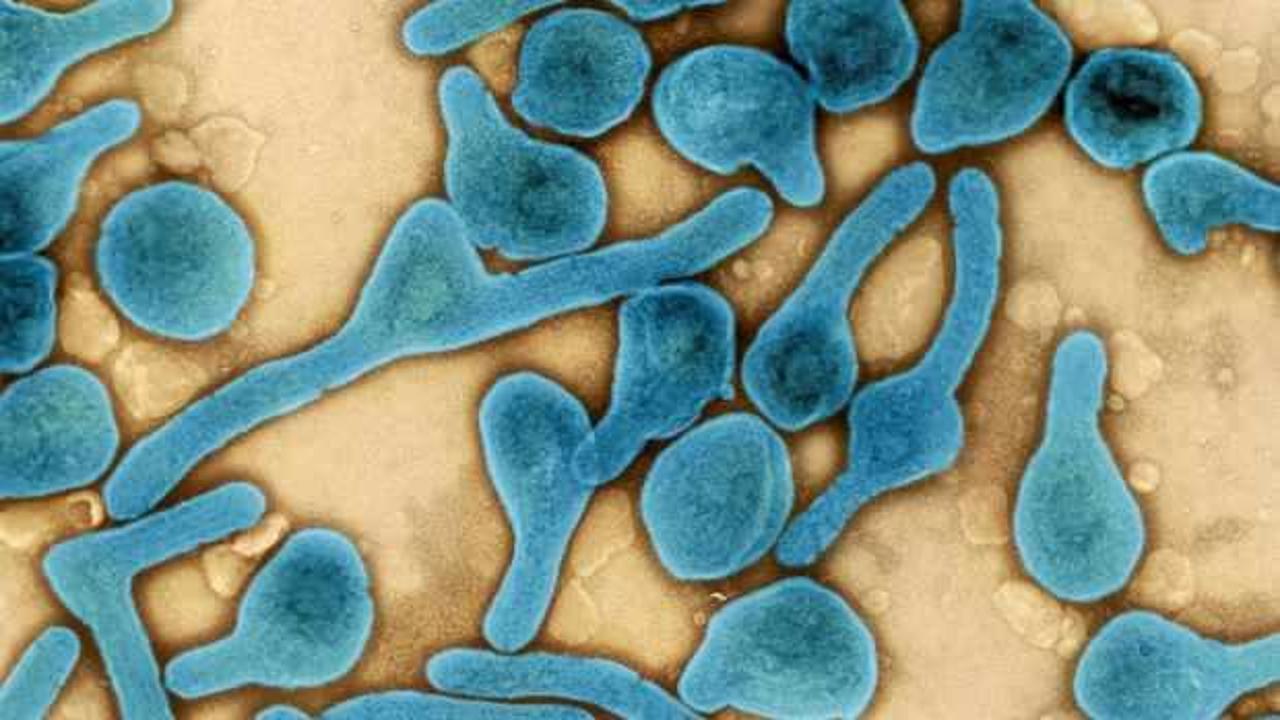 Ölümcül virüs paniği: Körfez ülkelerinden uyarı