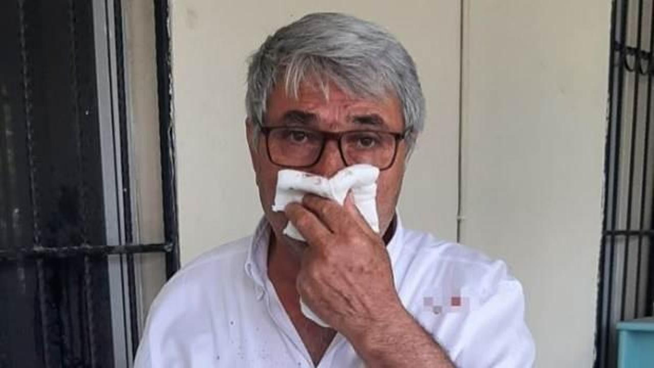 CHP'li Başkan Yardımcısı, muhtarın burnunu kırdı