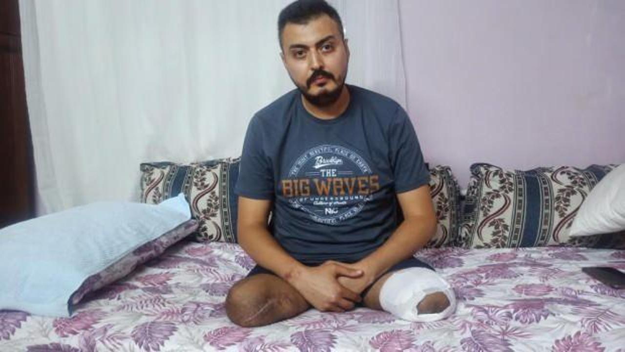 Yok b&ouml;yle acı! Eşi, iki &ccedil;ocuğu ve iki bacağını kaybetti