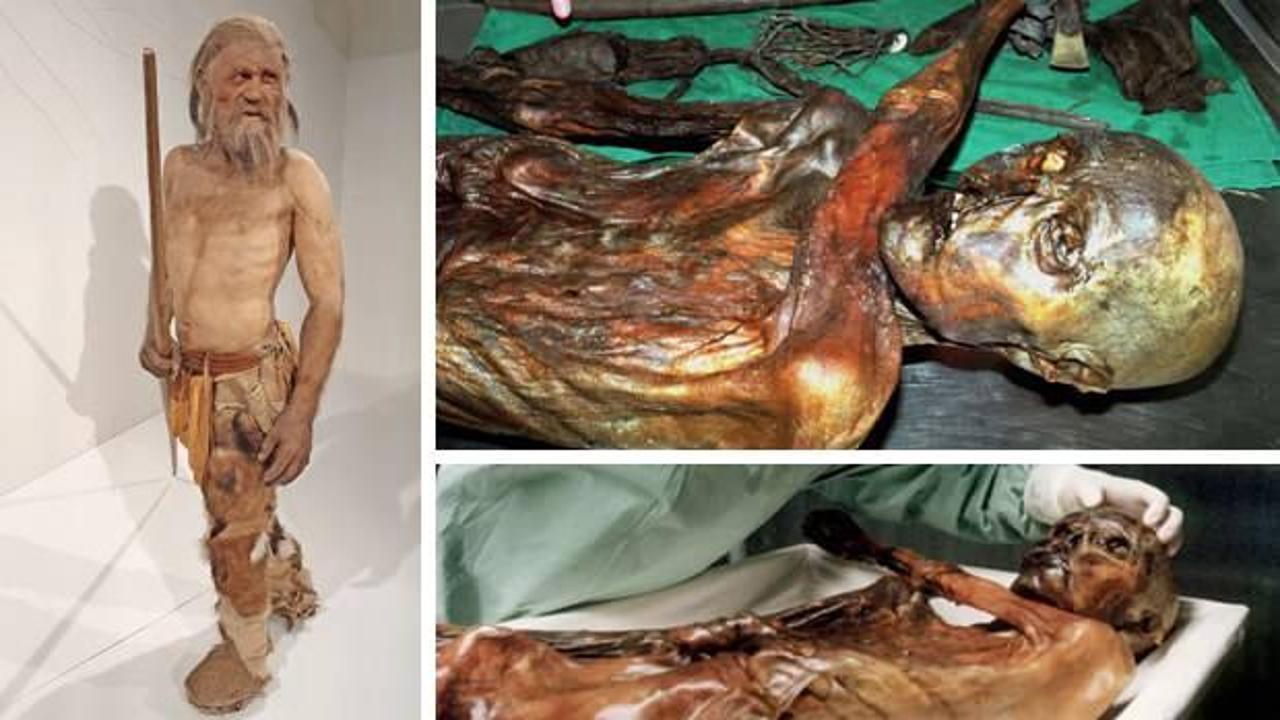 Buz adam &Ouml;tzi, Anadolulu &ccedil;ıktı