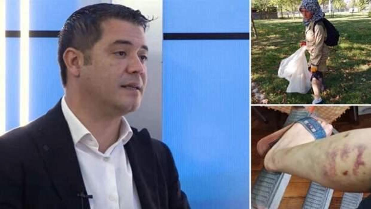 İBB'ye köpek soruşturması... Diğer personelleri de ısırmış!