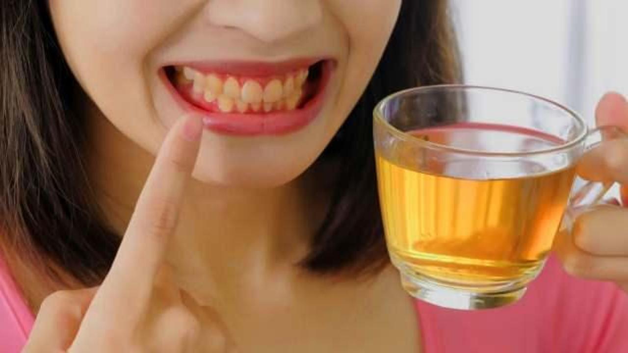 Çay yüzünden sararan dişlere çözüm: Diş lekeleri nasıl geçer, çay ve kahve dişlere zararlı mı? 