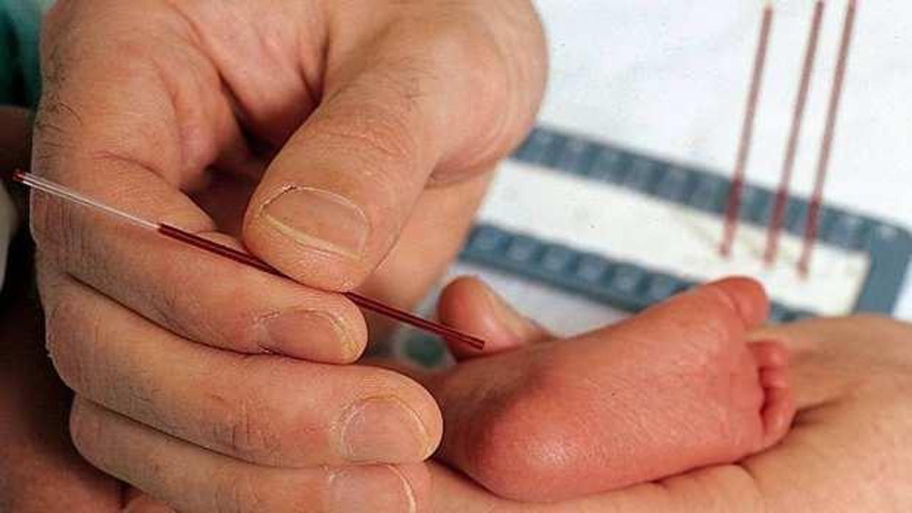 Fenilketonüri hastalığı nedir, belirtileri nelerdir? Bebeklerde fenilketonüri hastalığı belirtileri...